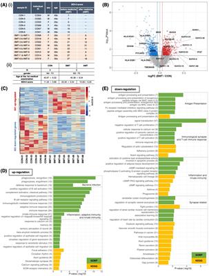 Intron retention as an excellent marker for diagnosing depression and for discovering new potential pathways for drug intervention